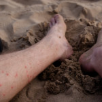 Ravaged by fleas after visiting some harmless sheep on a ranch. Best Christmas ever! Here I find respite by resting in the sand after briefly dipping my scabbed legs in the Mediterranean Sea.